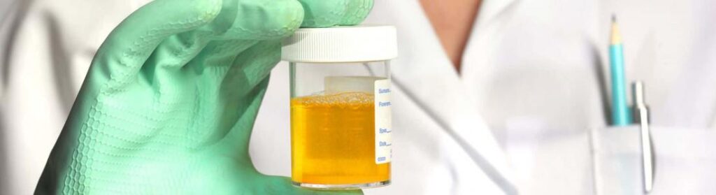 Piss poor: Inside the ‘sloppy’ practices of a military urinalysis lab